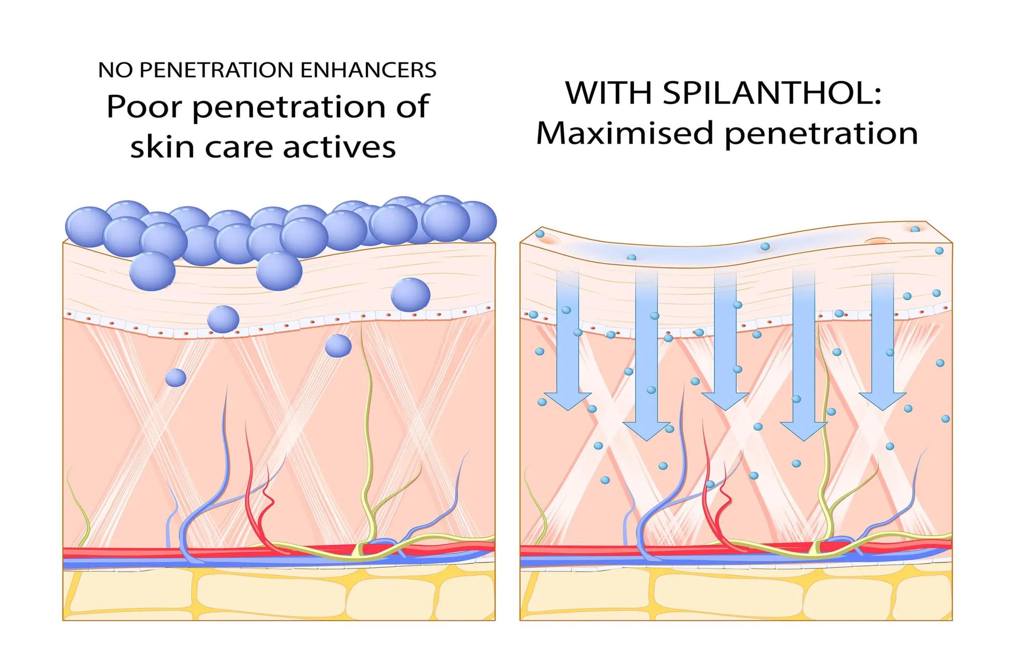 Cutaneous blood flow study